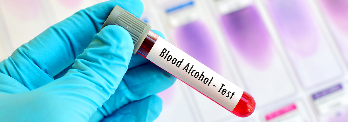 Blood Sample for Alcohol Test